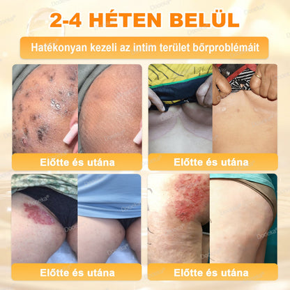 Dooeka® 𝟖-𝐈𝐧-𝟏 Méhméreg & Tallow Bőrfirmító és Regeneráló Krém 💥 (7 napon belül hatékony) Méhméreg + Tallow · 7X Mélyhidratálás, célozza meg a ráncokat, megereszkedést, striákat, sötét foltokat, purpurát, gyulladásokat és még sok mást.
