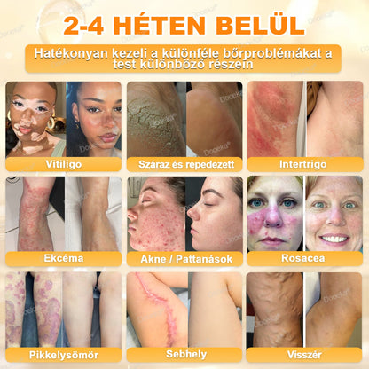 Dooeka® 𝟖-𝐈𝐧-𝟏 Méhméreg & Tallow Bőrfirmító és Regeneráló Krém 💥 (7 napon belül hatékony) Méhméreg + Tallow · 7X Mélyhidratálás, célozza meg a ráncokat, megereszkedést, striákat, sötét foltokat, purpurát, gyulladásokat és még sok mást.