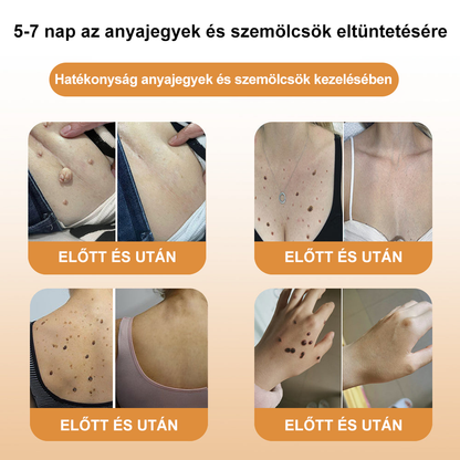 💝💝[✨Hivatalos Márkabolt✨] FROPUN™ Méhméreg Bőrgyulladás és Szemölcs Kezelő Krém(👨‍⚕️MSZ AJÁNLJA)