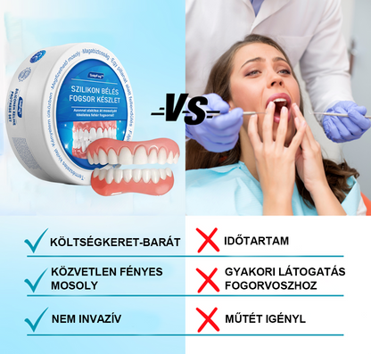 SzépFog™ Szilikon műfogsorbetét készlet (⏰60% kedvezmény korlátozott ideig, ma ingyenes szállítás!⏰)