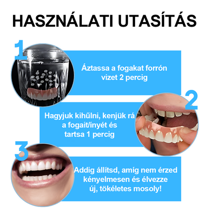 SzépFog™ 🦷Szilikon műfogsorbetét készlet🦷 (⏰60% kedvezmény korlátozott ideig, ma ingyenes szállítás!⏰)