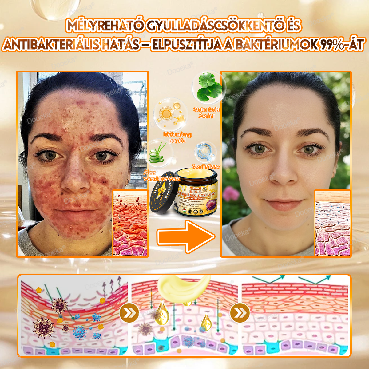 Dooeka® 𝟖-𝐈𝐧-𝟏 Méhméreg & Tallow Bőrfirmító és Regeneráló Krém 💥 (7 napon belül hatékony) Méhméreg + Tallow · 7X Mélyhidratálás, célozza meg a ráncokat, megereszkedést, striákat, sötét foltokat, purpurát, gyulladásokat és még sok mást.