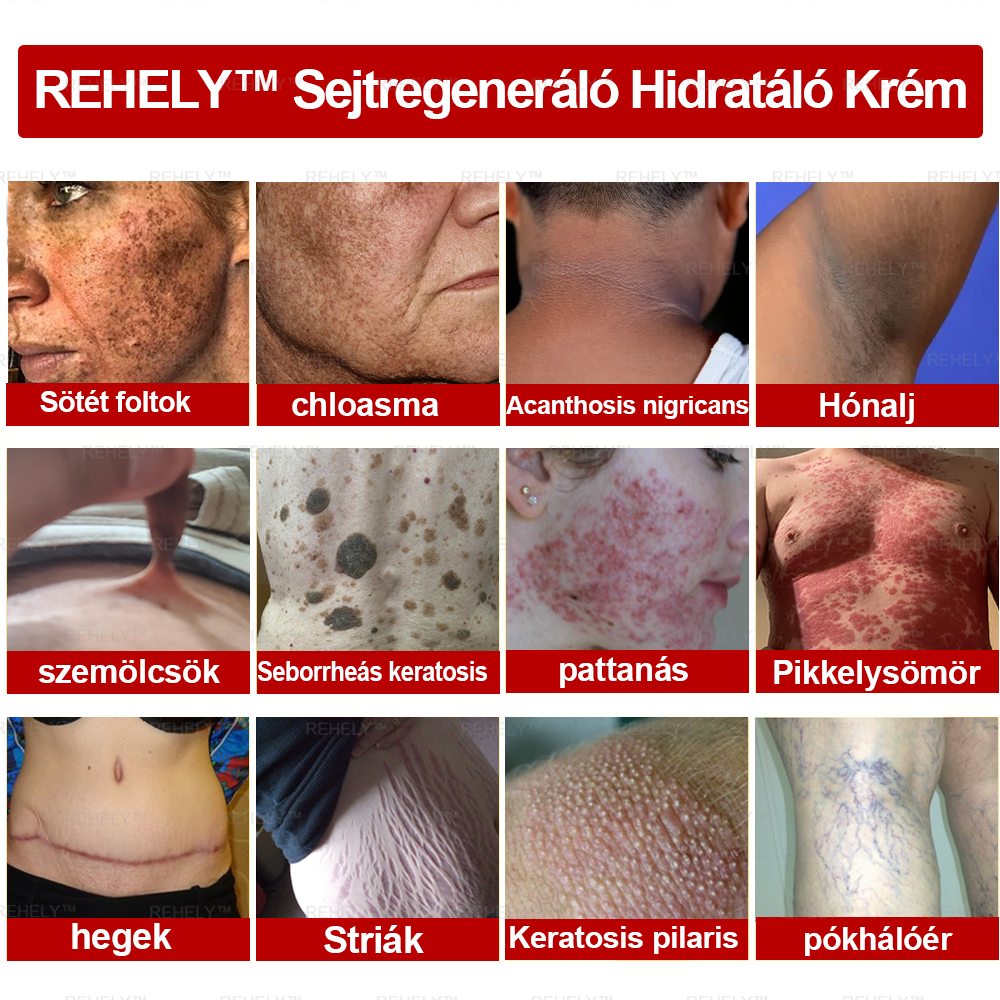 🌺REHELY™ Sejtregeneráló Hidratáló Krém | Tisztán vegán, állatkísérlet-mentes