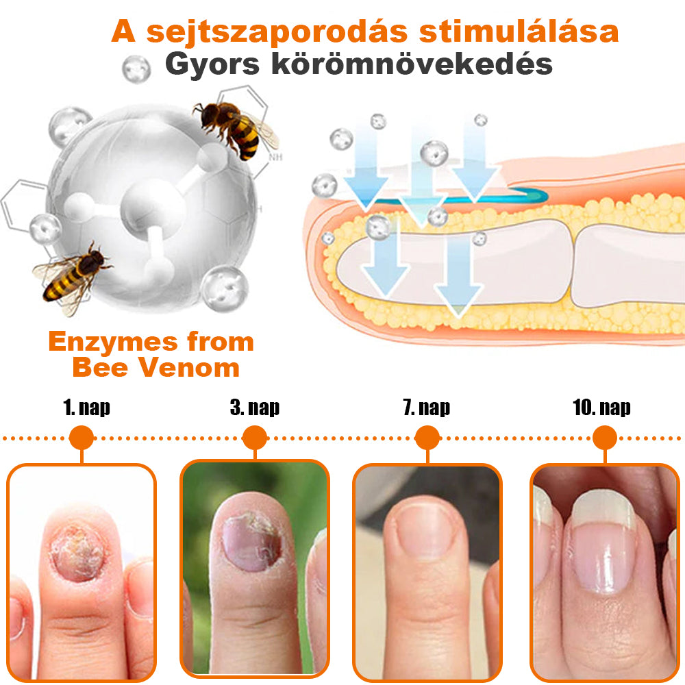 🐝【✨Hivatalos Üzlet✨】KörömVital™ Méhméreg Baktériumölő Körömkezelő Szérum (👨‍⚕️MSZ AJÁNLJA)