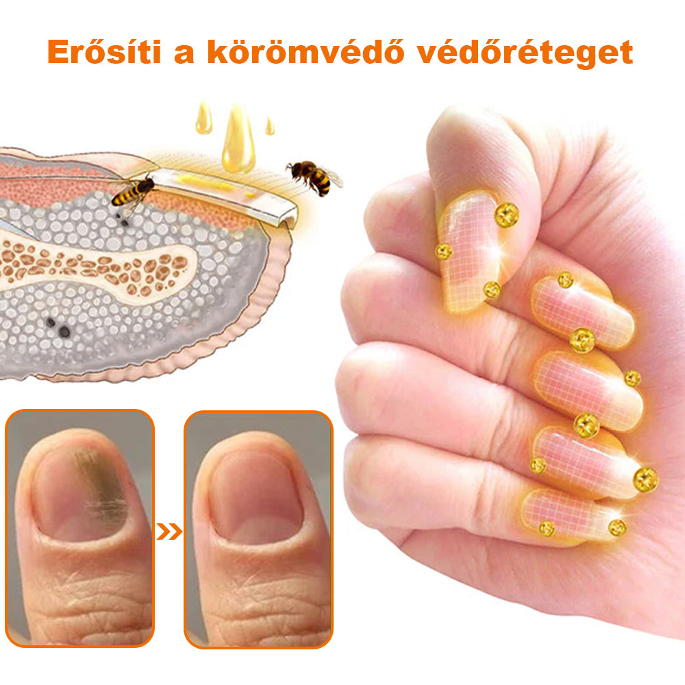 🐝【✨Hivatalos Üzlet✨】KörömVital™ Méhméreg Baktériumölő Körömkezelő Szérum (👨‍⚕️MSZ AJÁNLJA)