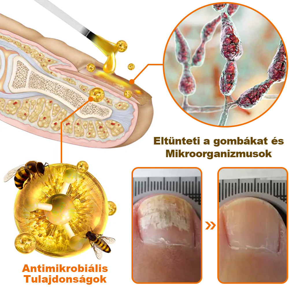 🐝【✨Hivatalos Üzlet✨】KörömVital™ Méhméreg Baktériumölő Körömkezelő Szérum (👨‍⚕️MSZ AJÁNLJA)