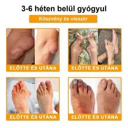 Gbpurity® Botulinum Toxin & Méhméreg Fájdalomcsillapító Krém – Hivatalos Márkabolt, MOT Jóváhagyással